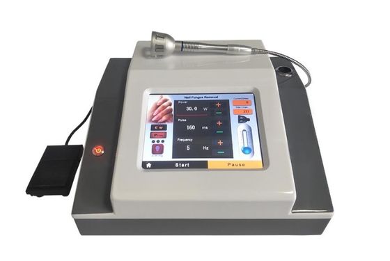 980nm Diode Laser Treatment of Onychomycosis Nails Fungus Removal